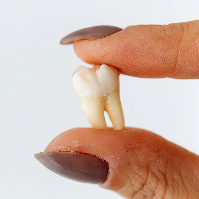 baby teeth traditions 2023 700 - A&M Dental Arts